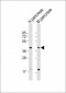 GMPPB Antibody (N-Term)